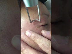 Mesin Laser Pikodetik 450ps 1064nm 532nm Q Beralih Nd Yag