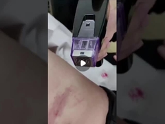 50W Fraksi RF Microneedle Machine 100V hingga 240V