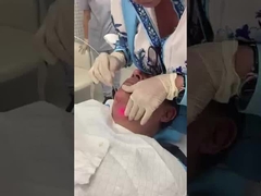 Area Pengobatan Abdomen Laser Lipolysis 1470nm Diode Fiber Laser Machine